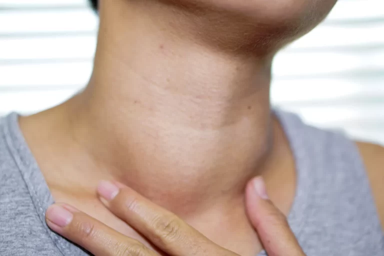 thyroid-nodule-large