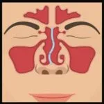 sinus-doctor-deviatednasalseptum