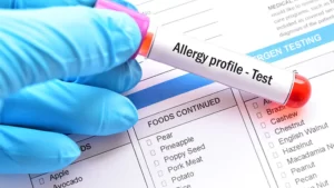 blood_test_allergies