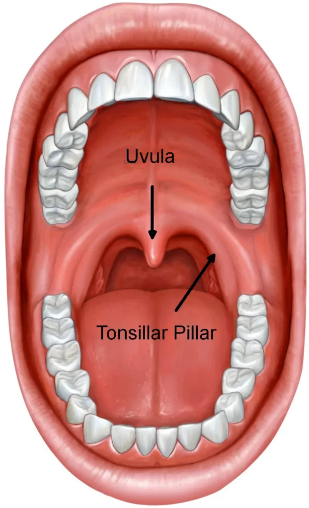 tonsil_grading_anatomy