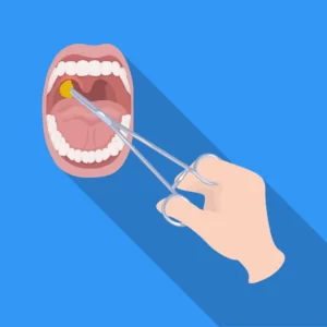 tonsillectomy_tonsil_removal_in_Singapore
