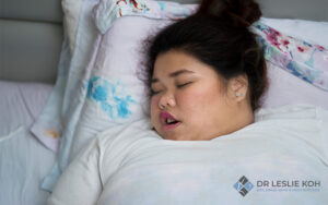 woman sleeping in her bed with mouth open